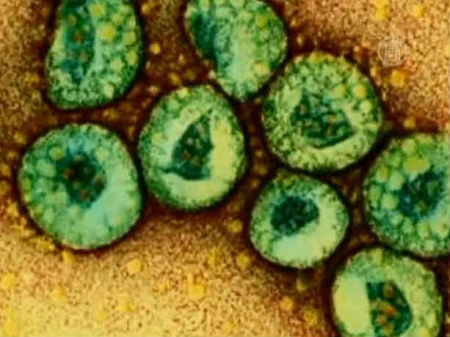 Коронавирус MERS что это, симптомы