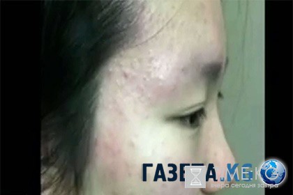 Сотни китайских подростков заболели в отравленной химкомбинатом школе