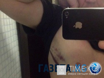 Нападение на блогера Адагамова в Киеве попало на ВИДЕО Нападение на блогера Адагамова в Киеве попало на ВИДЕО