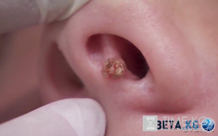 Я соромлюсь свого тіла 3: смотреть онлайн выпуск от 5.05.2016