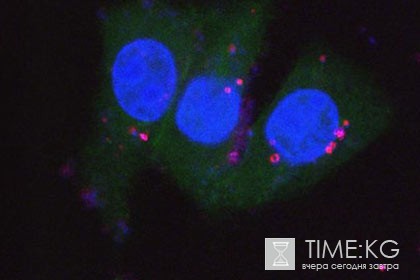 В МГУ научились «подсвечивать» раковые опухоли наночастицами