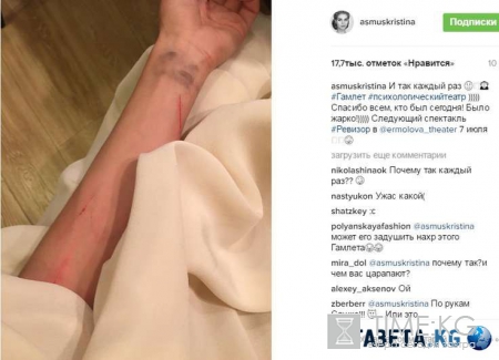 Кристина Асмус получила шокирующие травмы во время спектакля – поклонники актрисы в ужасе