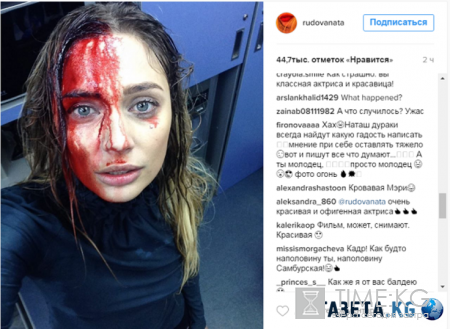 «Окровавленная» Наталья Рудова пожелала своим подписчикам хорошего дня