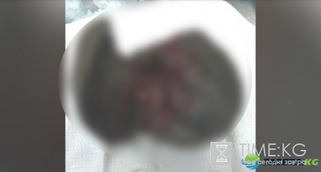 Американец шокировал соцсети снимком печени своей полуторагодовалой дочери