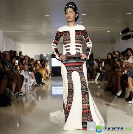 Модель, обожженная кислотой затмила красоток на Неделе моды в Нью-Йорке: фото и видео Решмы Куреши взорвали интернет