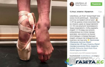 Анастасия Волочкова instagram: Волочкова показала натруженные балетом ноги