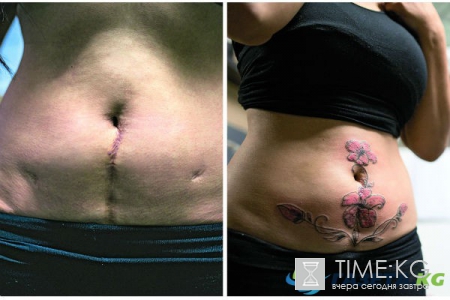 Женщина из Уфы бесплатно делает татуировки на шрамах жертв насилия