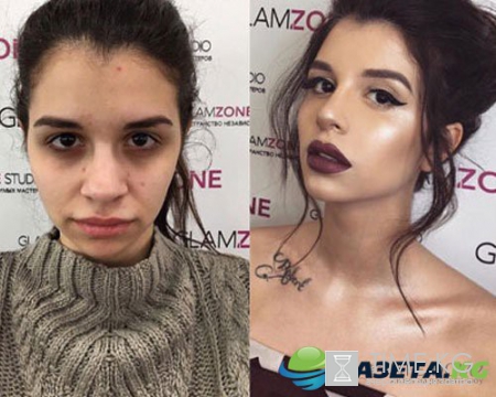 Все лицо Алианы покрыто прыщами. Фото