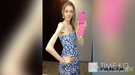 Девушка-анорексичка потрясла общество новыми снимками