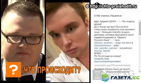 «Я - Кен, а ты кто?»: Экс-участник «Дом2» шокировал поклонников результатами пластики