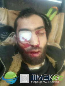 Взаимное истребление: Сирийские боевики массово вырезают друг друга ФОТО 18+ Взаимное истребление: Сирийские боевики массово вырезают друг друга ФОТО 18+