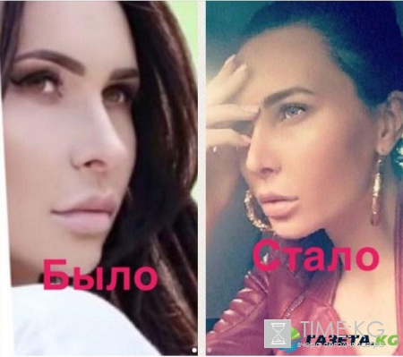 Поклонники не оценили новый нос Элины Камирен