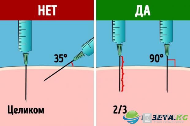 Как самостоятельно сделать укол: подробная инструкция для новичков Как самостоятельно сделать укол: подробная инструкция для новичков
