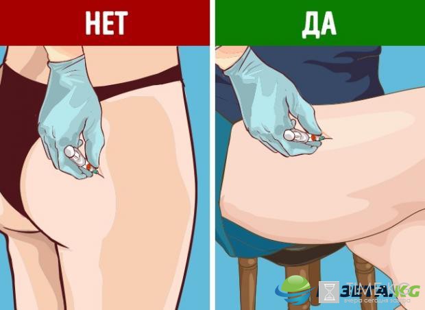 Как самостоятельно сделать укол: подробная инструкция для новичков Как самостоятельно сделать укол: подробная инструкция для новичков